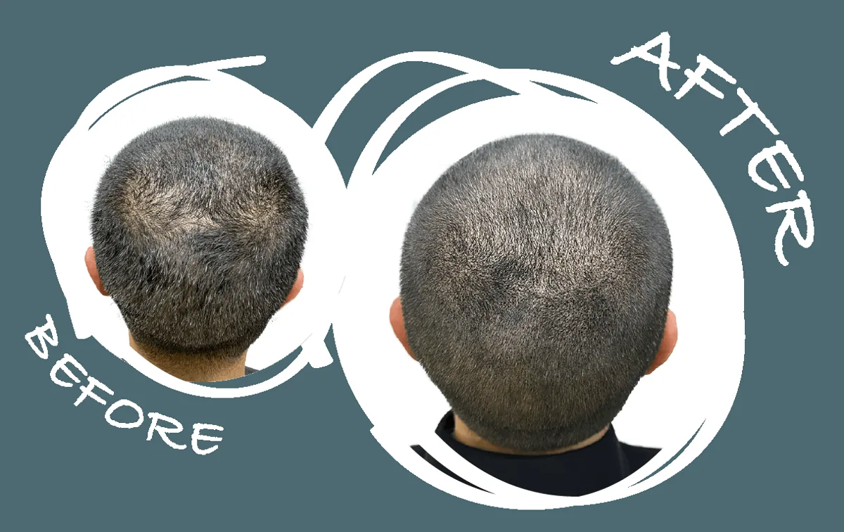 SMP before and after 9
