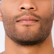 Beard Micropigmentation
