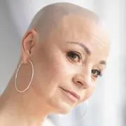 Alopecia
