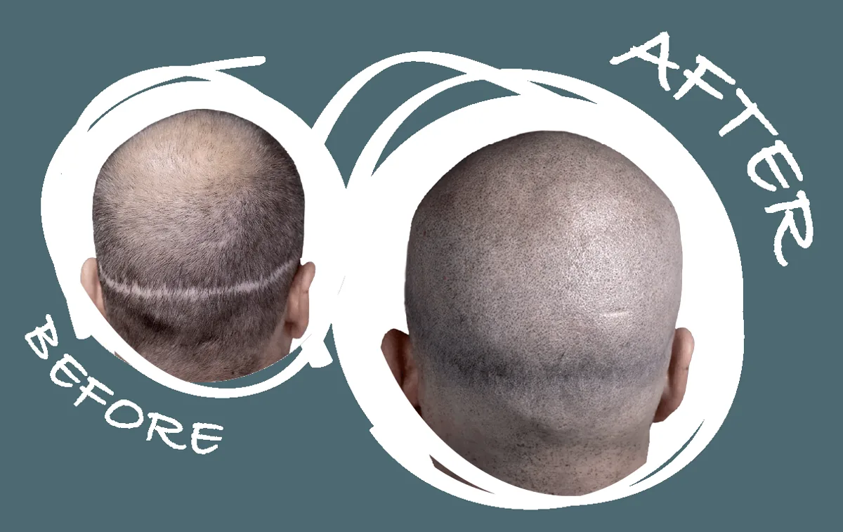 SMP before and after 8